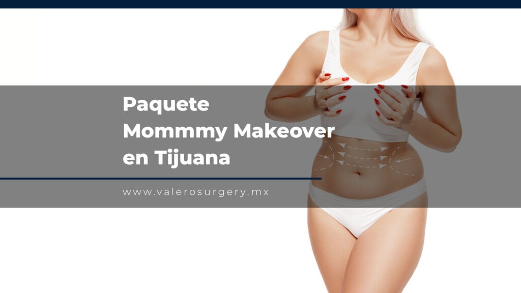 Paquete Mommy Makeover en Tijuana